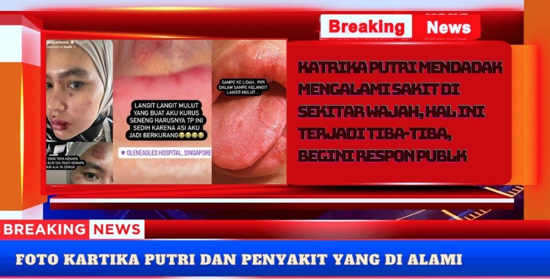 Kartika Putri Tiba-tiba Mengalami Sakit di Sekitar Wajah: Penyebab dan Respons Publik