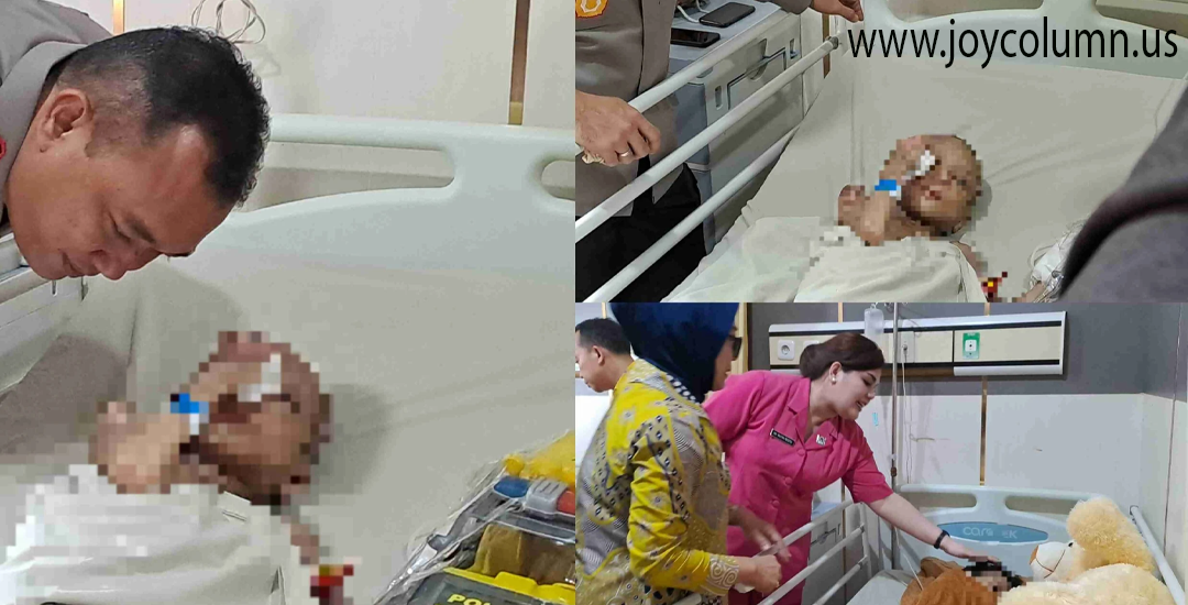 Kasus Tragis di Makassar Dua Bocah Disekap Disiram Air Panas